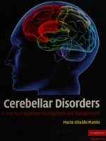 cerebellar disorders: a practical approach to diagnosis and management