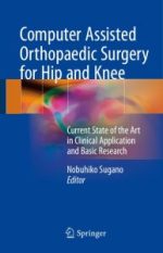 computer assisted orthopaedic surgery for hip and knee: current state of the art in clinical application and basic research