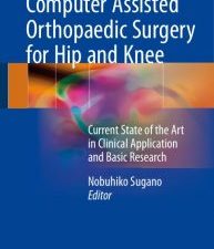 computer assisted orthopaedic surgery for hip and knee: current state of the art in clinical application and basic research