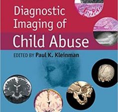 diagnostic imaging of child abuse edition 3