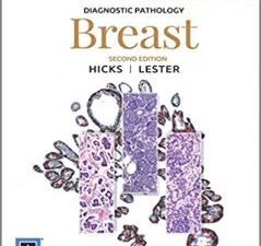 diagnostic pathology: breast 2nd edition