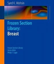 frozen section library: breast