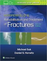 hoppenfeld’s treatment and rehabilitation of fractures second edition