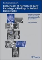 koehler/zimmer’s borderlands of normal and early pathological findings in skeletal radiography