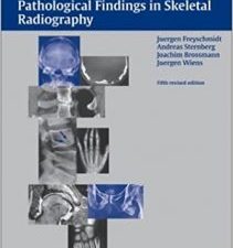 koehler/zimmer’s borderlands of normal and early pathological findings in skeletal radiography