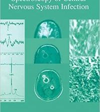 mr imaging and spectroscopy of central nervous system infection 2001st edition