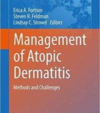 management of atopic dermatitis: methods and challenges