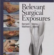 master techniques in orthopaedic surgery: relevant surgical exposures 1st edition