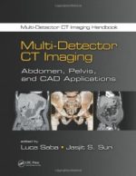 multi detector ct imaging: abdomen, pelvis, and cad applications