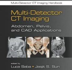 multi detector ct imaging: abdomen, pelvis, and cad applications