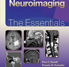 neuroimaging: the essentials