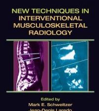new techniques in interventional musculoskeletal radiology