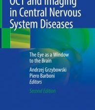 oct and imaging in central nervous system diseases: the eye as a window to the brain