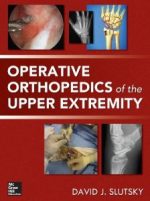 operative orthopedics of the upper extremity 1st edition