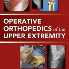 operative orthopedics of the upper extremity 1st edition