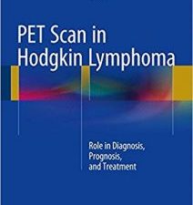 pet scan in hodgkin lymphoma: role in diagnosis, prognosis, and treatment
