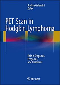 pet scan in hodgkin lymphoma: role in diagnosis, prognosis, and treatment