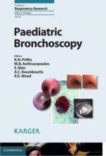 paediatric bronchoscopy
