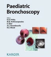 paediatric bronchoscopy