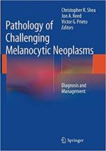 pathology of challenging melanocytic neoplasms: diagnosis and management