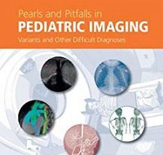 pearls and pitfalls in pediatric imaging: variants and other difficult diagnoses
