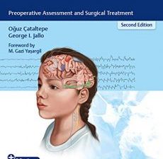 pediatric epilepsy surgery, 2nd edition