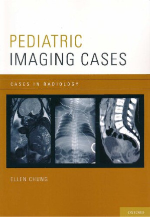pediatric imaging cases (cases in radiology) illustrated edition