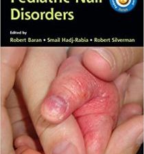 pediatric nail disorders (pediatric diagnosis and management) 1st edition