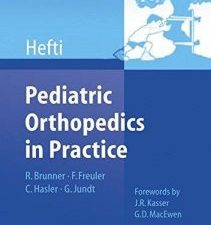 pediatric orthopedics in practice