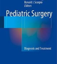pediatric surgery: diagnosis and treatment