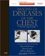imaging of diseases of the chest: expert consult – 5th edition