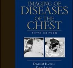 imaging of diseases of the chest: expert consult – 5th edition
