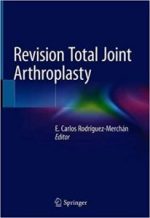 revision total joint arthroplasty