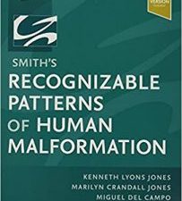 smith’s recognizable patterns of human malformation: expert consult – online and print 8th edition