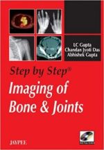 step by step imaging of bone and joints 1st edition