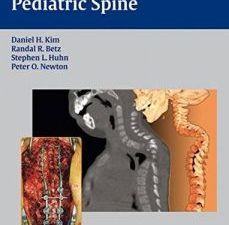 surgery of the pediatric spine