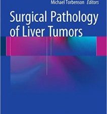 surgical pathology of liver tumors