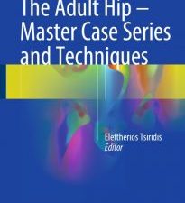 the adult hip – master case series and techniques
