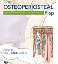 the osteoperiosteal flap: a simplified approach to alveolar bone reconstruction
