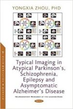 typical imaging in atypical parkinson’s, schizophrenia, epilepsy and asymptomatic alzheimer’s disease