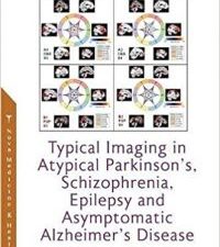 typical imaging in atypical parkinson’s, schizophrenia, epilepsy and asymptomatic alzheimer’s disease
