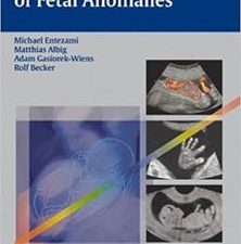 ultrasound diagnosis of fetal anomalies