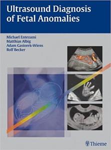 ultrasound diagnosis of fetal anomalies