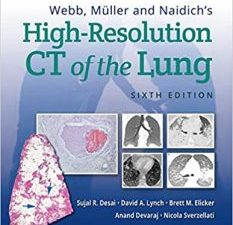 webb, müller and naidich’s high resolution ct of the lung sixth edition