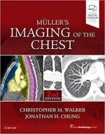 muller’s imaging of the chest: expert radiology series (2nd edition)