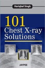 101 chest x ray solutions 1st edition