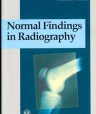 normal findings in radiography 1st edition