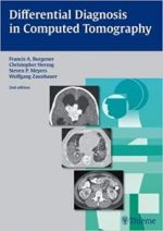 differential diagnosis in computed tomography 2nd edition