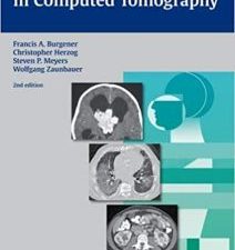 differential diagnosis in computed tomography 2nd edition