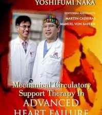 mechanical circulatory support therapy in advanced heart failure illustrated edition